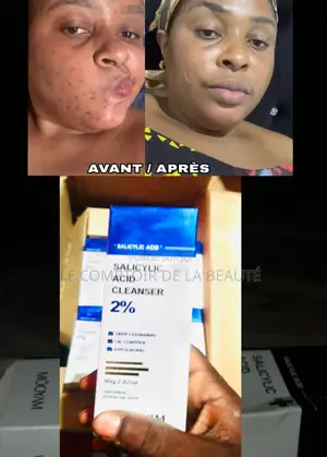  Annonce Flash : Teint Net Zéro Brillance 